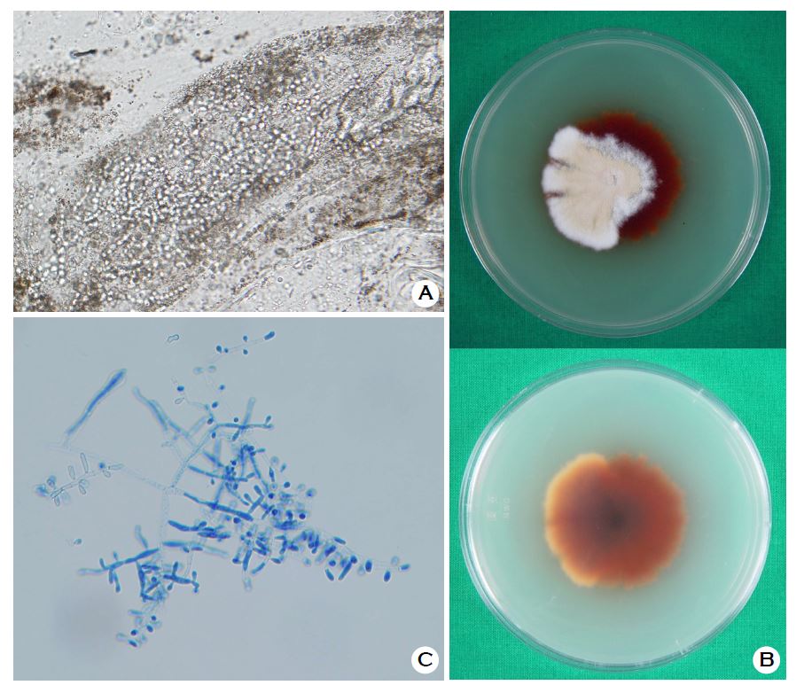 arthroconidia