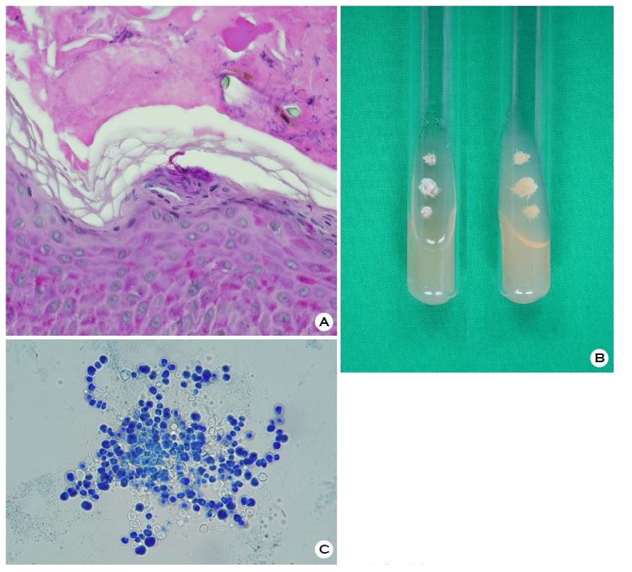 JMI - The Journal of mycology and infection