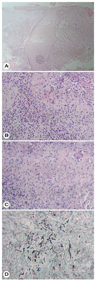 JMI - The Journal of mycology and infection