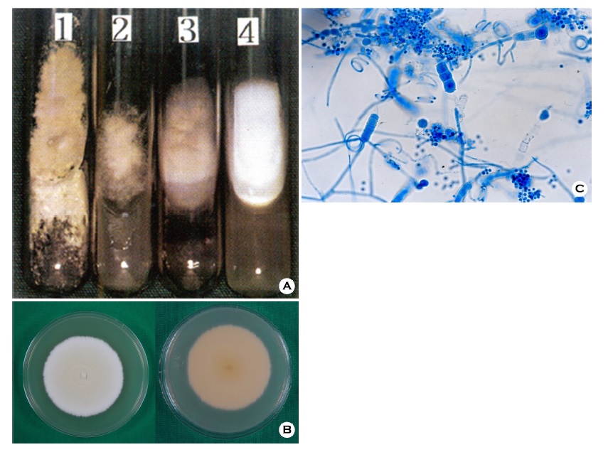 PDF] Tinea Manuum Caused by Trichophyton mentagrophytes var