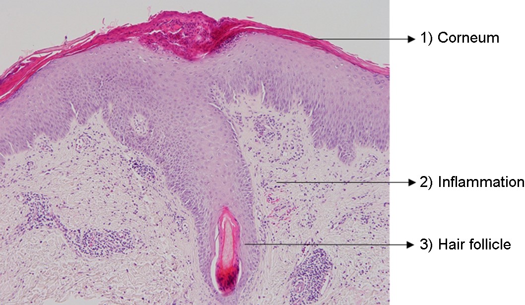 JMI - The Journal of mycology and infection