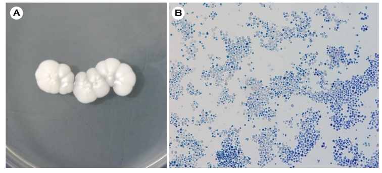 JMI - The Journal of mycology and infection