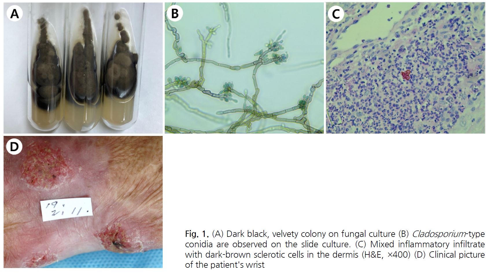 JMI - The Journal of mycology and infection