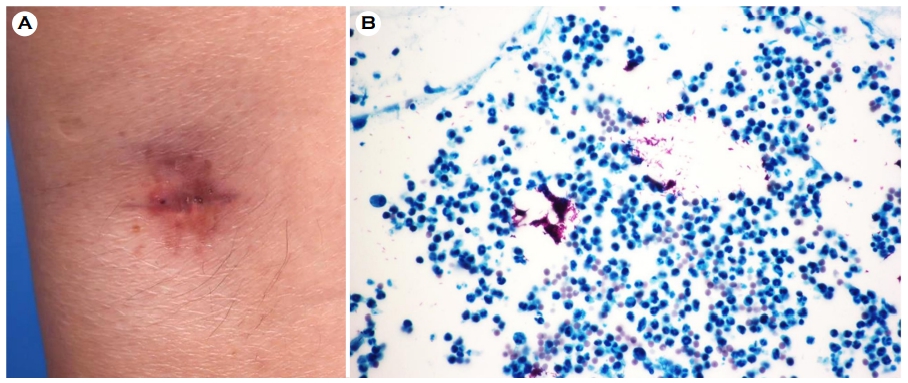 JMI - The Journal of mycology and infection